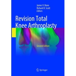 Revision Total Knee Arthroplasty