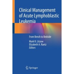 Clinical Management of Acute Lymphoblastic Leukemia: From Bench to Bedside