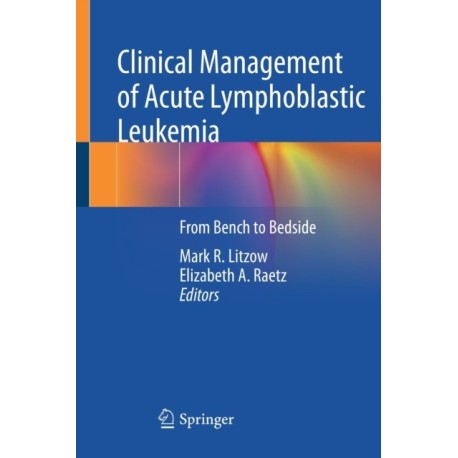Clinical Management of Acute Lymphoblastic Leukemia: From Bench to Bedside
