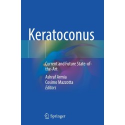 Keratoconus: Current and Future State-of-the-Art