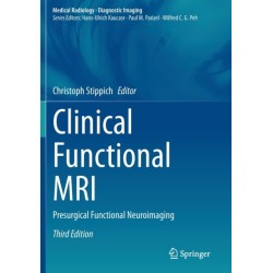 Clinical Functional MRI: Presurgical Functional Neuroimaging