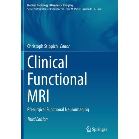 Clinical Functional MRI: Presurgical Functional Neuroimaging
