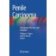 Penile Carcinoma: Therapeutic Principles and Advances