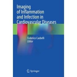 Imaging of Inflammation and Infection in Cardiovascular Diseases