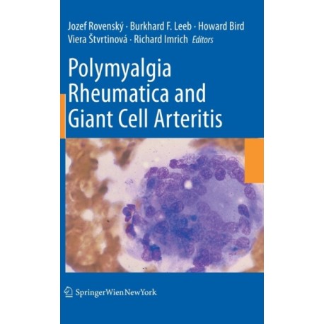 Polymyalgia Rheumatica and Giant Cell Arteritis