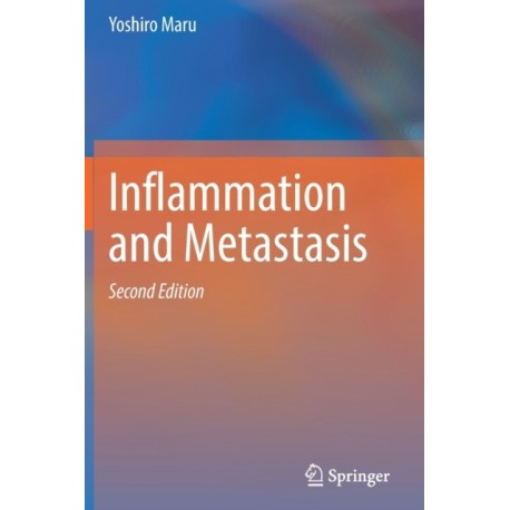 Inflammation and Metastasis