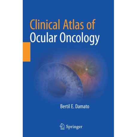 Clinical Atlas of Ocular Oncology