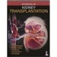 Textbook of Kidney Transplantation