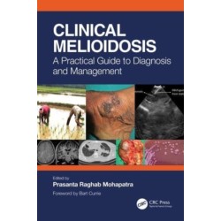 Clinical Melioidosis: A Practical Guide to Diagnosis and Management