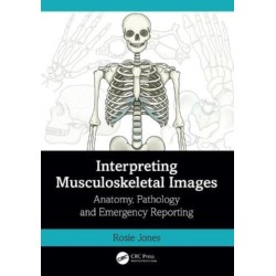 Interpreting Musculoskeletal Images: Anatomy, Pathology and Emergency Reporting