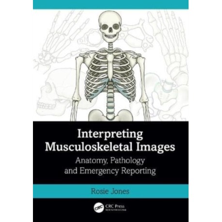 Interpreting Musculoskeletal Images: Anatomy, Pathology and Emergency Reporting