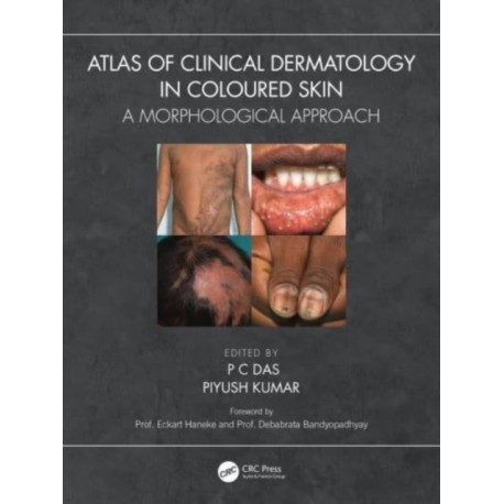 Atlas of Clinical Dermatology in Coloured Skin: A Morphological Approach