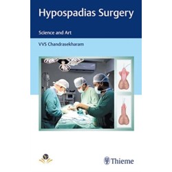 Hypospadias Surgery: Science and Art