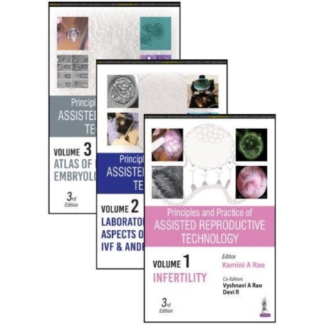 Principles and Practice of Assisted Reproductive Technology: Three Volume Set