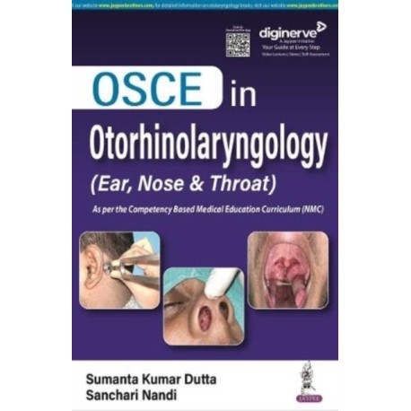 OSCE in Otorhinolaryngology: (Ear, Nose & Throat)
