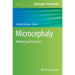 Microcephaly: Methods and Protocols