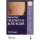 Step by Step Treatment of Acne Scars