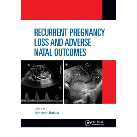 Recurrent Pregnancy Loss and Adverse Natal Outcomes