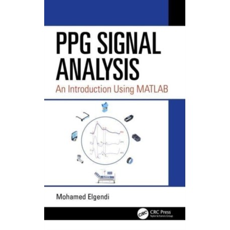 PPG Signal Analysis: An Introduction Using MATLAB®