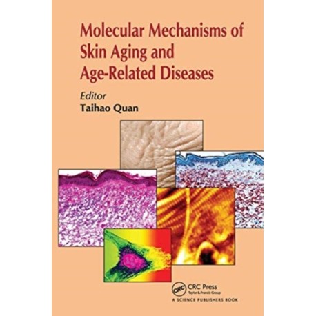 Molecular Mechanisms of Skin Aging and Age-Related Diseases