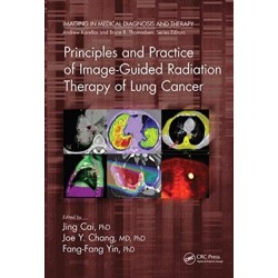 Principles and Practice of Image-Guided Radiation Therapy of Lung Cancer