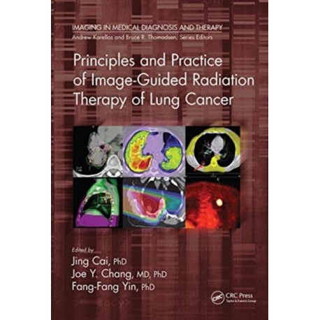 Principles and Practice of Image-Guided Radiation Therapy of Lung Cancer