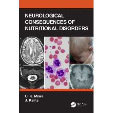 Neurological Consequences of Nutritional Disorders