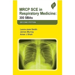 MRCP SCE in Respiratory Medicine: 300 SBAs