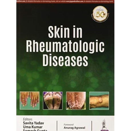 Skin in Rheumatologic Diseases