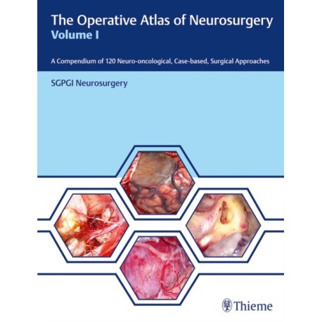 The Operative Atlas of Neurosurgery, Vol I: A Compendium of 120 Neuro-oncological, Case-based, Surgical Approaches