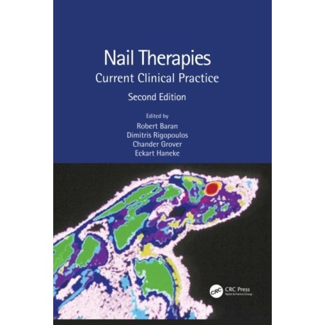 Nail Therapies: Current Clinical Practice