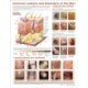 Common Lesions and Disorders of the Skin Anatomical Chart