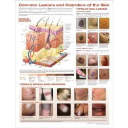 Common Lesions and Disorders of the Skin Anatomical Chart
