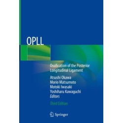 OPLL: Ossification of the Posterior Longitudinal Ligament