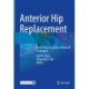Anterior Hip Replacement: From Origin to Current Advanced Techniques