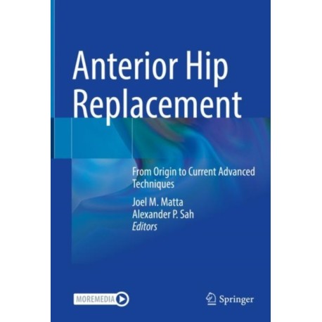 Anterior Hip Replacement: From Origin to Current Advanced Techniques