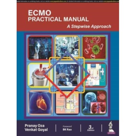 ECMO Practical Manual: A Stepwise Approach
