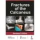 Fractures of the Calcaneus