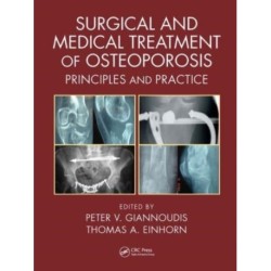 Surgical and Medical Treatment of Osteoporosis: Principles and Practice