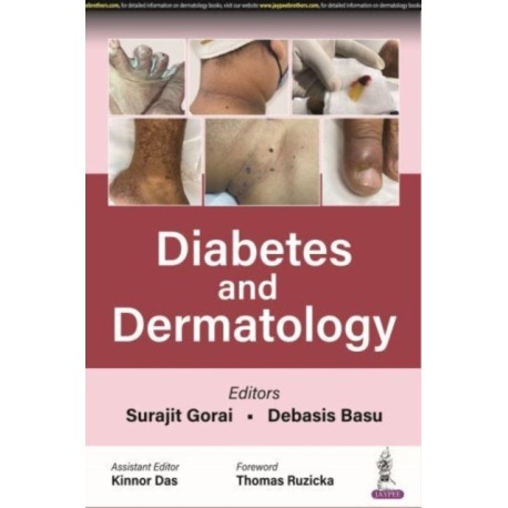 Diabetes and Dermatology