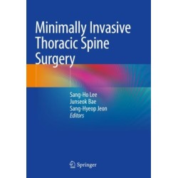 Minimally Invasive Thoracic Spine Surgery