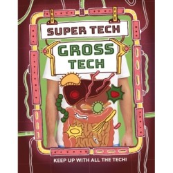 Super Tech: Gross Tech