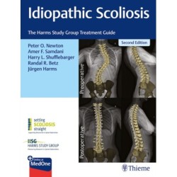 Idiopathic Scoliosis: The Harms Study Group Treatment Guide
