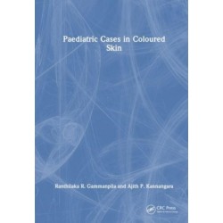 Paediatric Cases in Coloured Skin