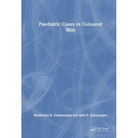 Paediatric Cases in Coloured Skin