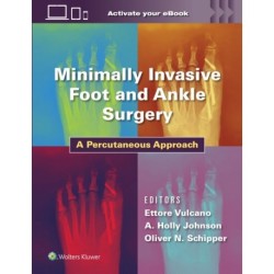 Minimally Invasive Foot and Ankle Surgery: A Percutaneous Approach