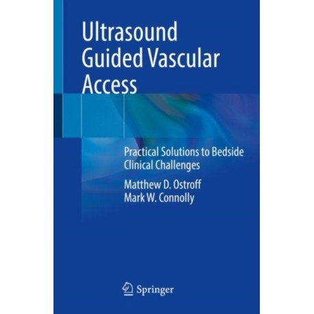 Ultrasound Guided Vascular Access: Practical Solutions to Bedside Clinical Challenges
