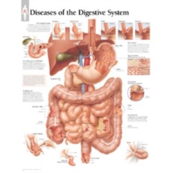 Diseases of the Digestive System Paper Poster
