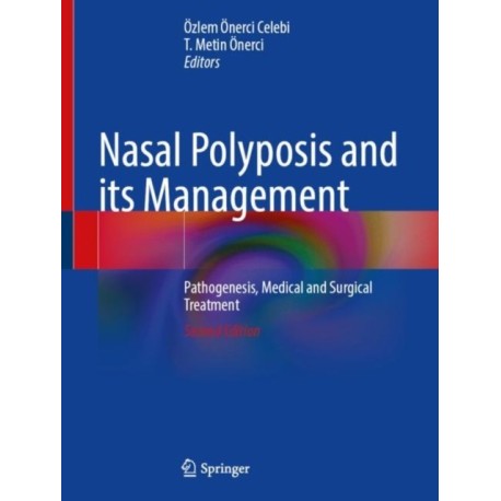 Nasal Polyposis and its Management: Pathogenesis, Medical and Surgical Treatment