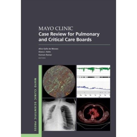 Mayo Clinic Case Review for Pulmonary and Critical Care Boards
